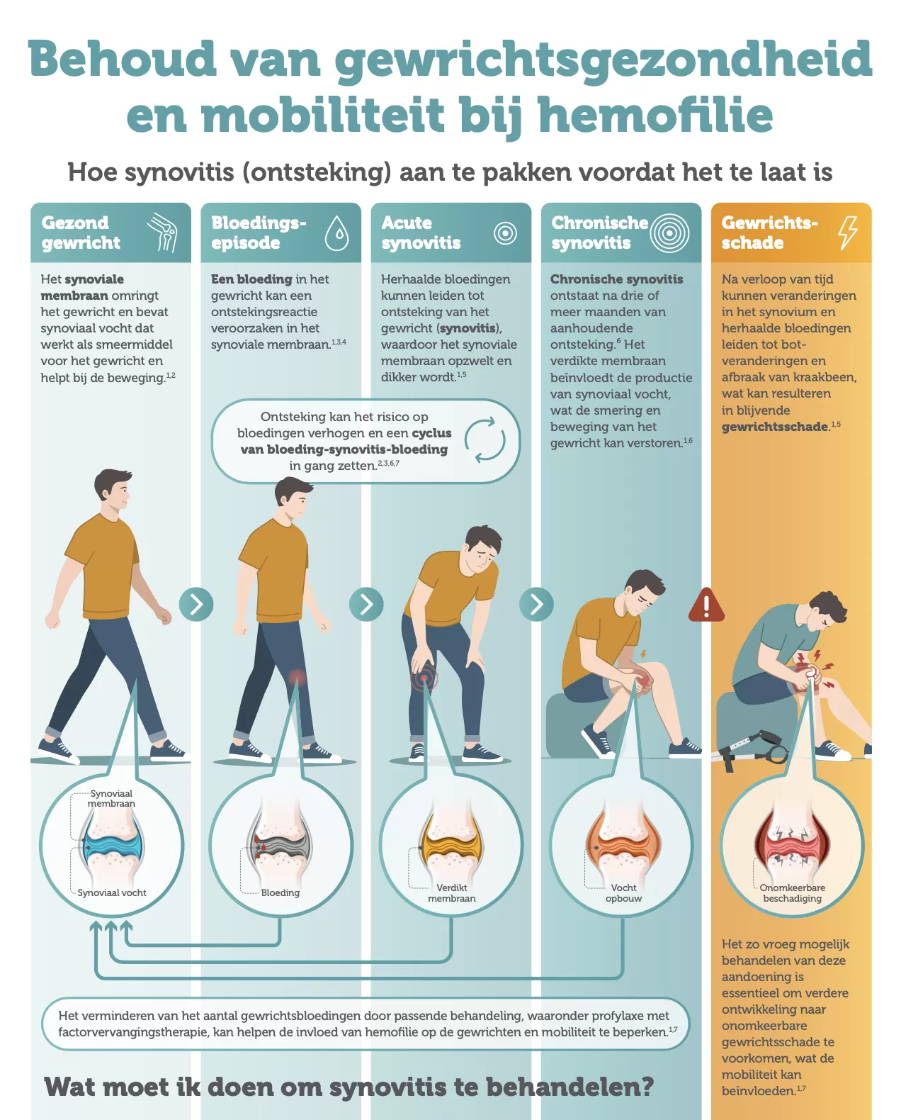 Bovenzijde infographic Behoud van gewrichtsgezondheid en mobiliteit bij hemofilie