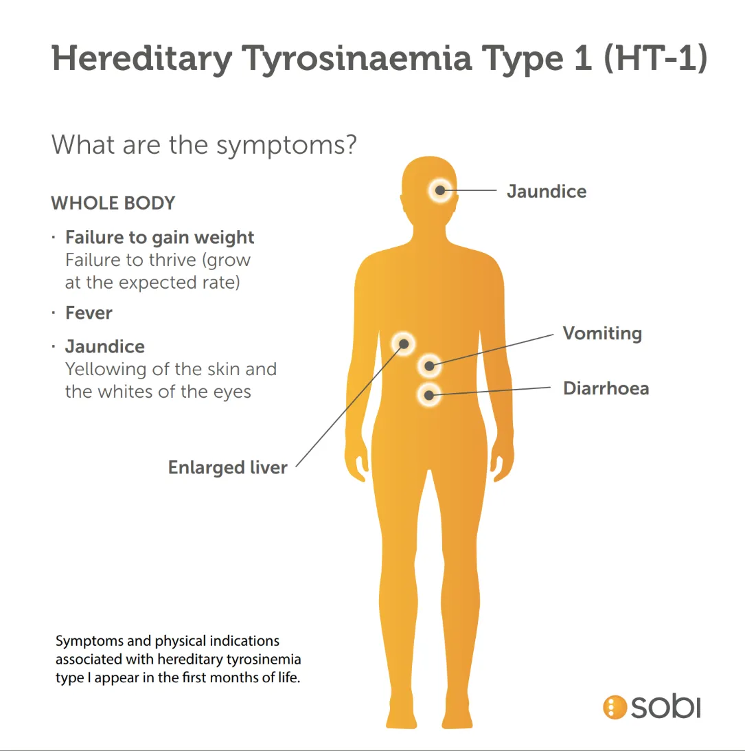 Hereditary-Tyrosinaemia-Type -1 - infographic